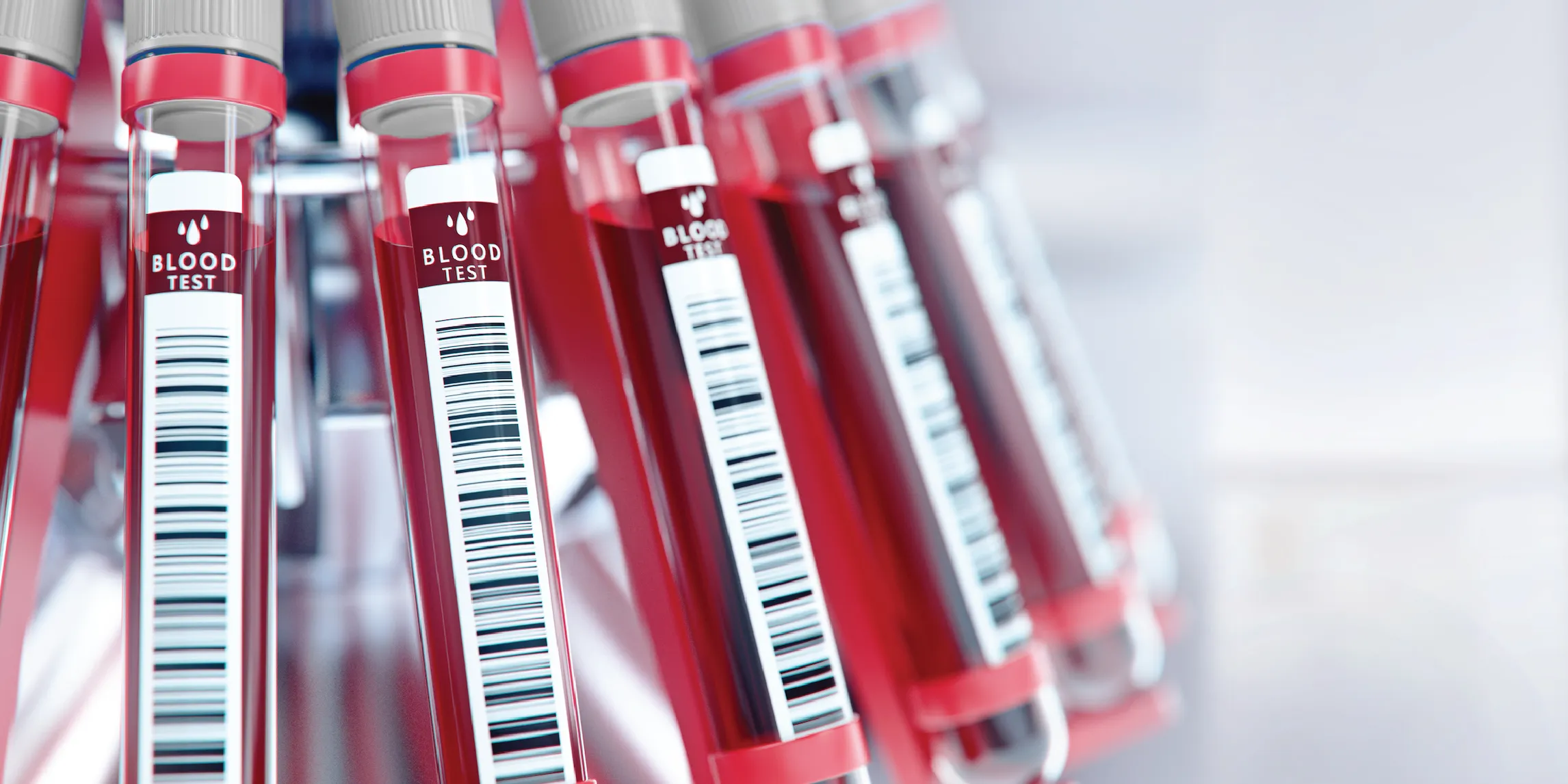 What Does Routine Blood Work Check For? Next Health